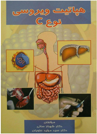 هپاتیت ویروسی نوع C